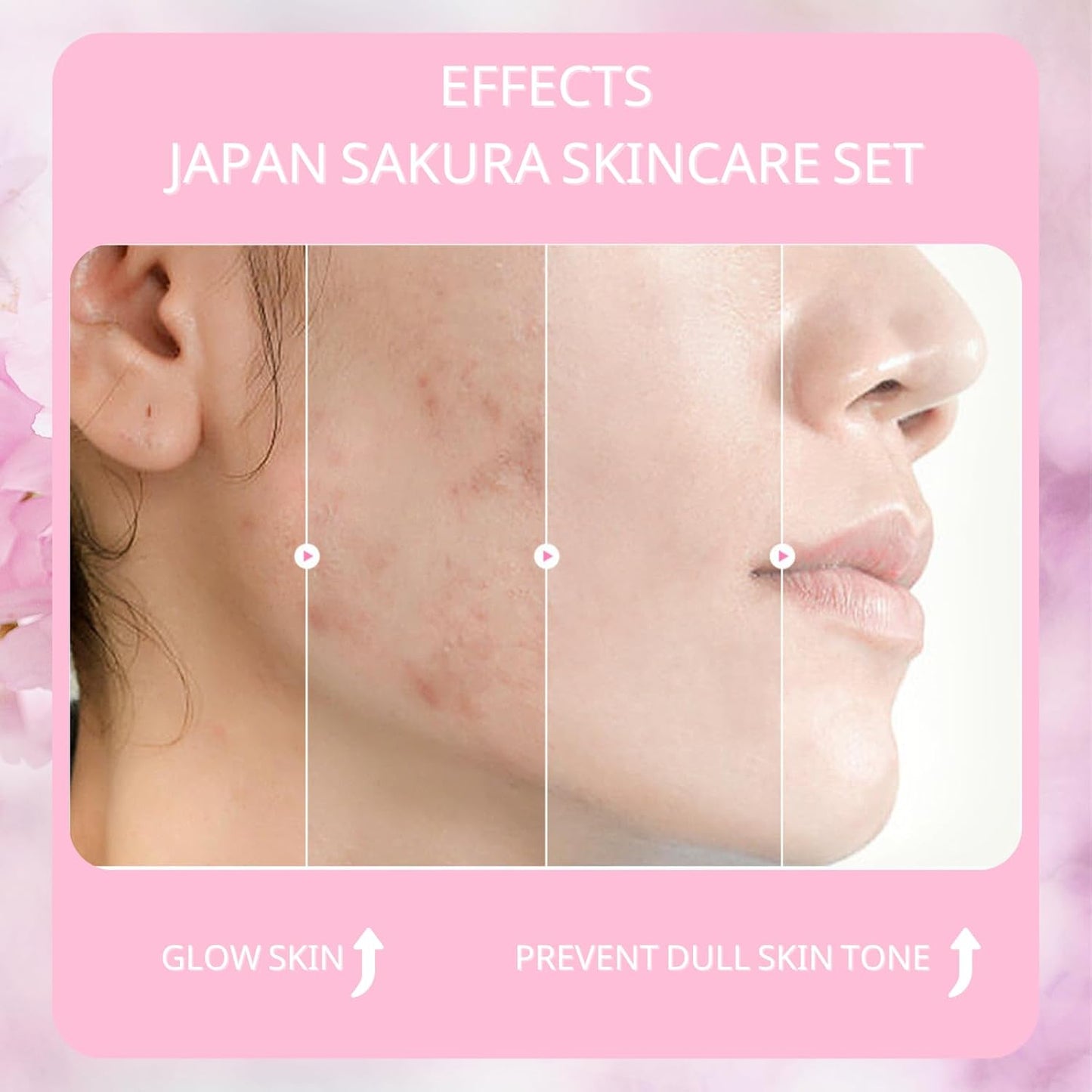JAPAN SAKURA 5 IN 1 SKIN CARE SET