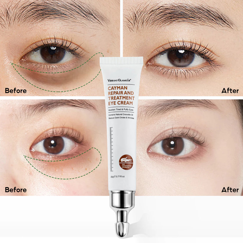 VIBRANT GLAMOUR Cayman Repair & Treatment Eye Cream 20g