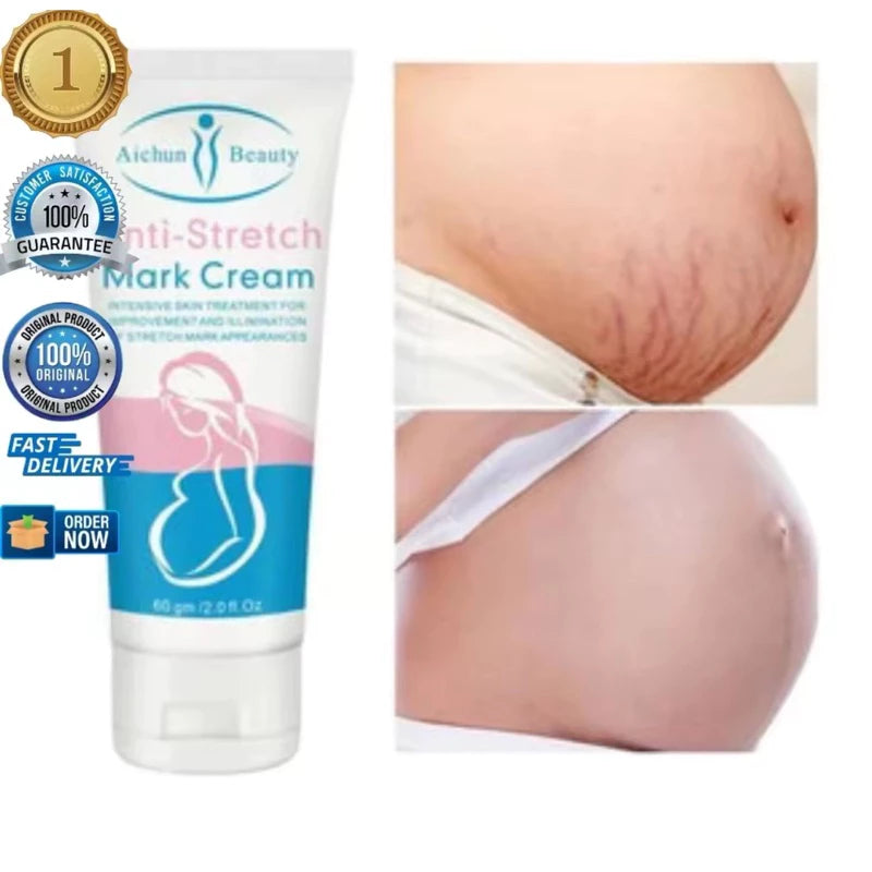 Anti-Stretch Mark Cream