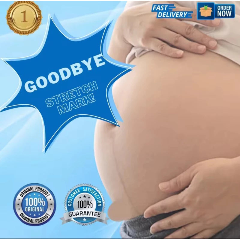 Anti-Stretch Mark Cream