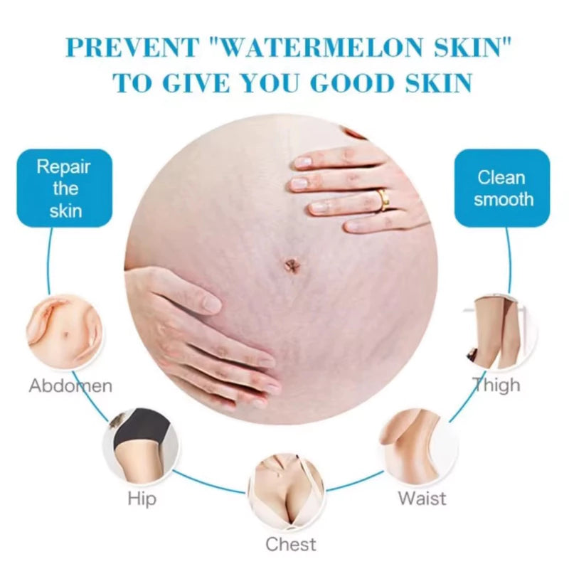 Anti-Stretch Mark Cream