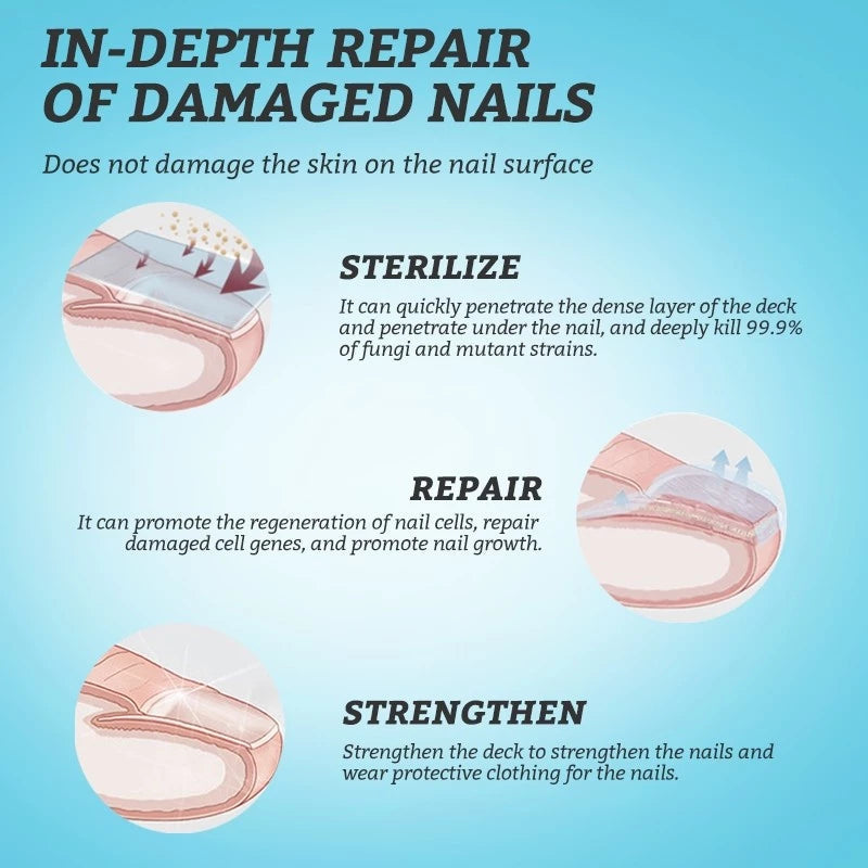 RtopR Ginger Antibacterial Nail Treatment