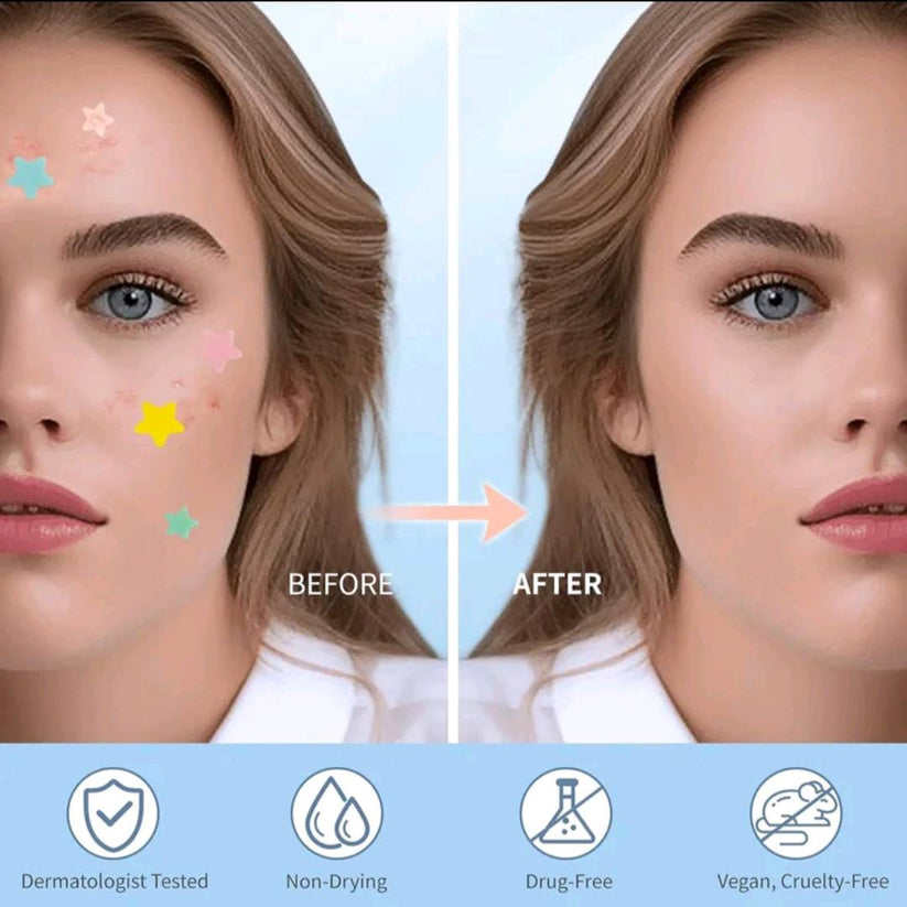 Star Pimple Patch