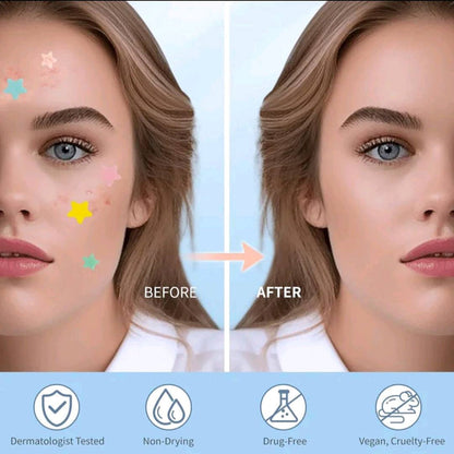 Star Pimple Patch