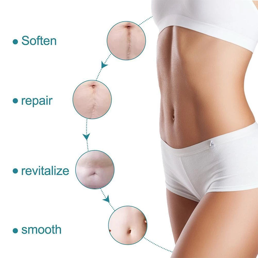 Silicone Scar Sheets