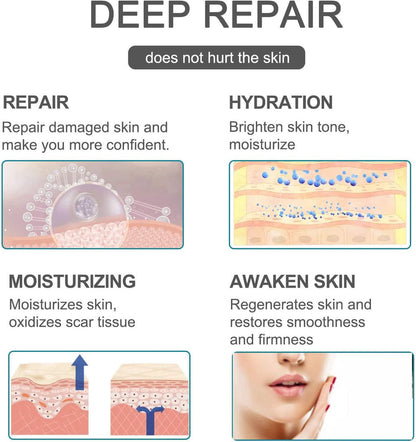 Silicone Scar Sheets