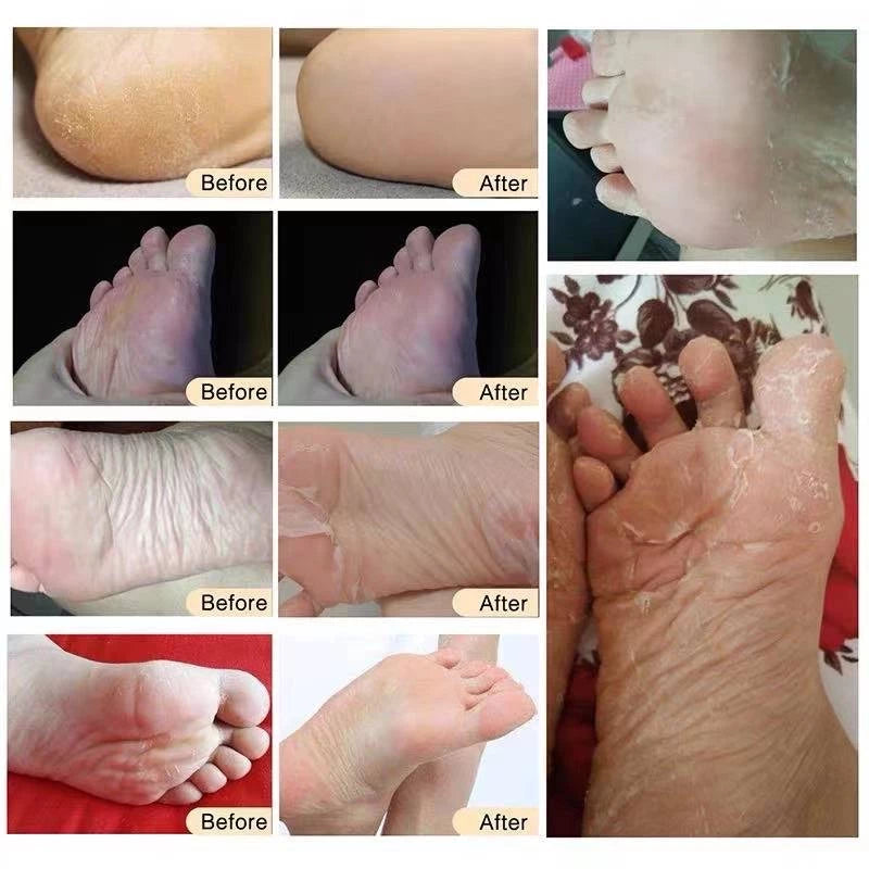 SUNISA Exfoliating Foot Mask 3 PACKS!