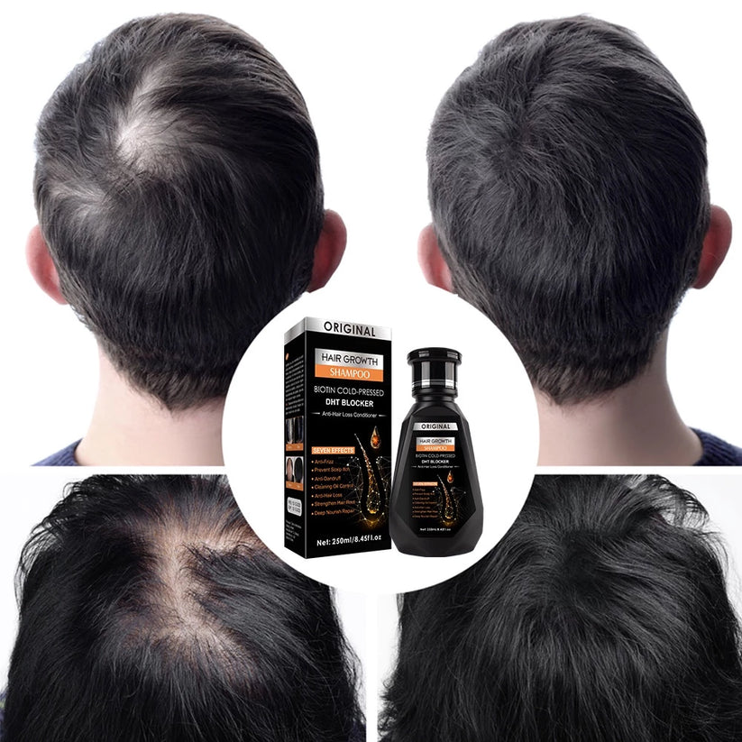 Ginger Hair Growth Shampoo 250ml