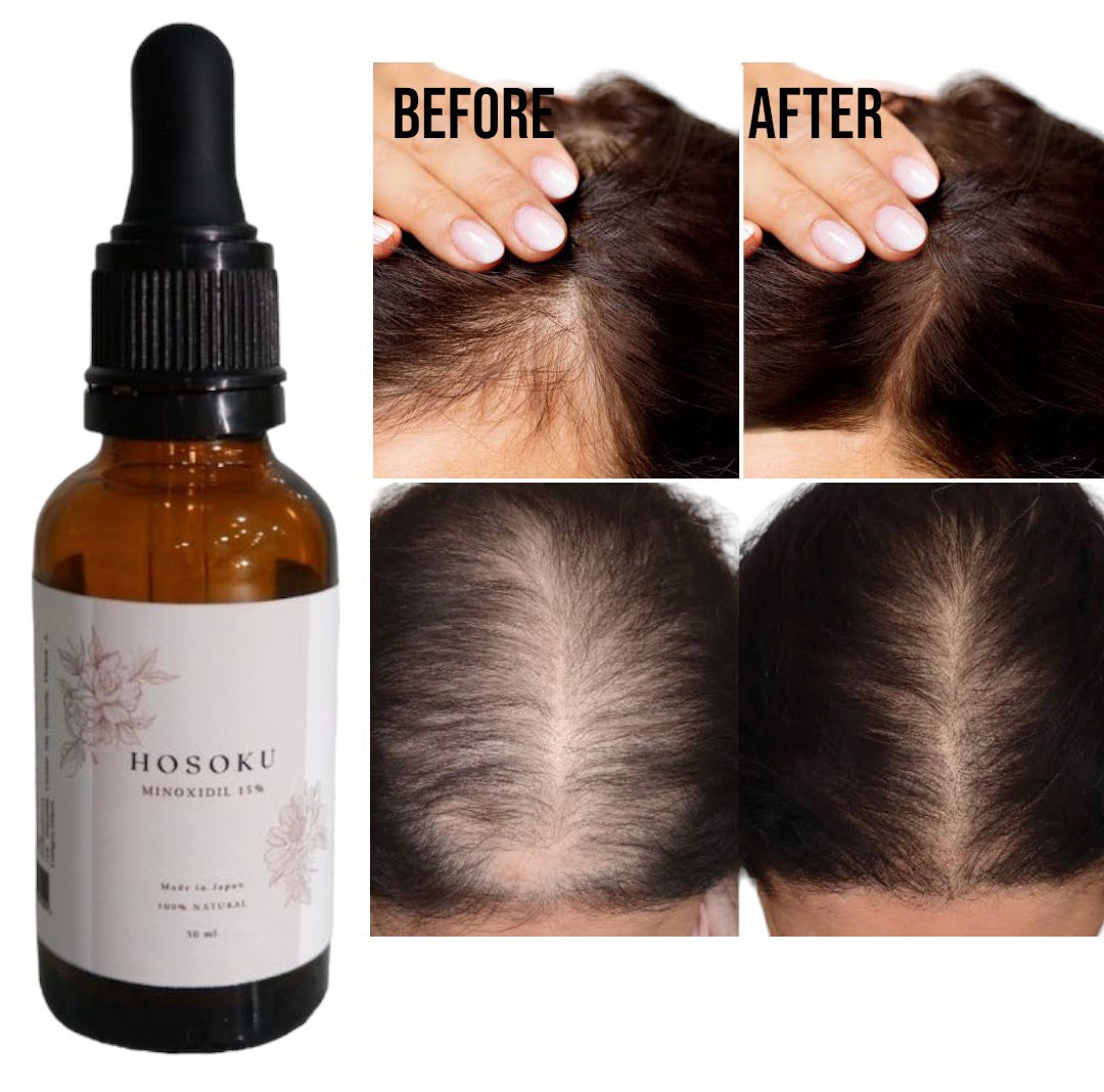 AUTHENTIC MINOXIDIL HOSOKU 15% HAIR GROWTH