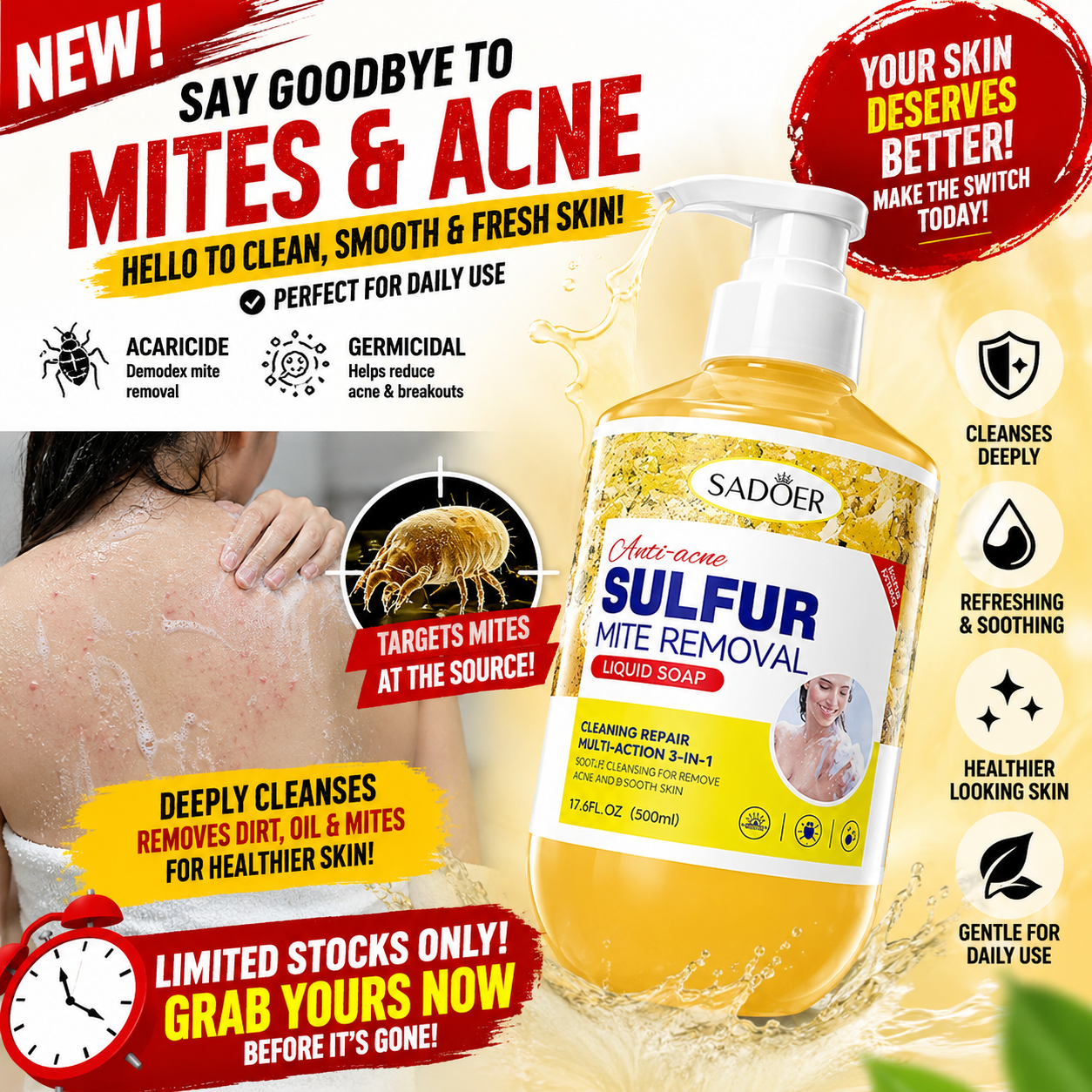 SADOER Sulfur Mite Removal Body Wash 500ml