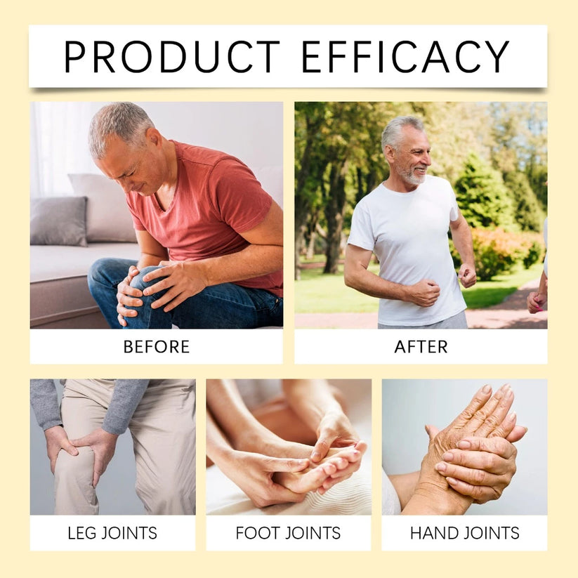 SOUTH MOON Bee Venom Pain Relief Cream for Arthritis, Muscle & Joint Soreness