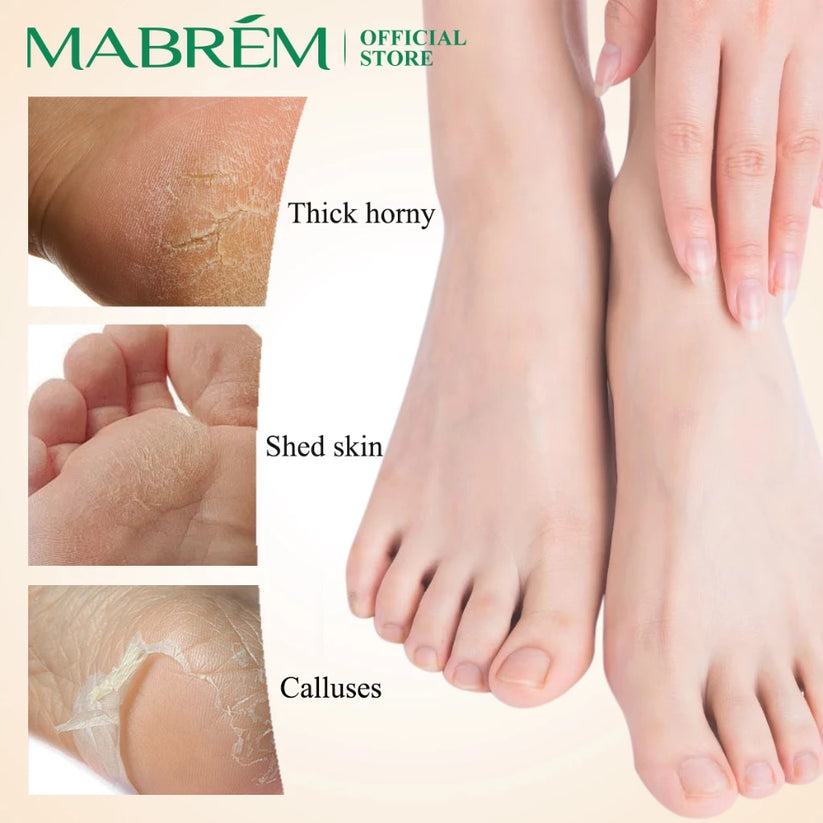 MABREM Foot Treatment Cream