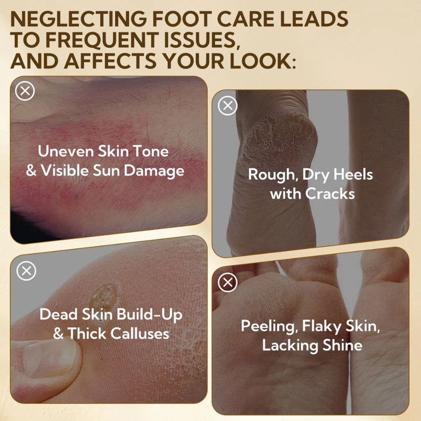 LANBENA Foot Peel Mask