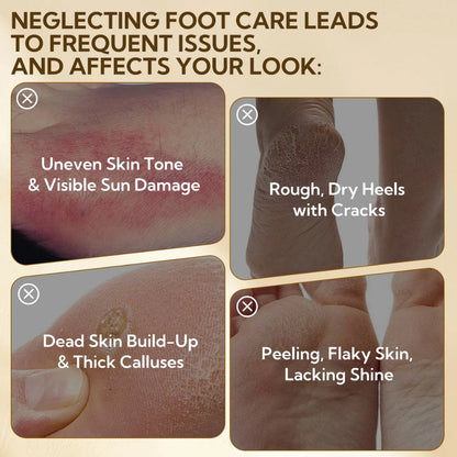 LANBENA Foot Peel Mask