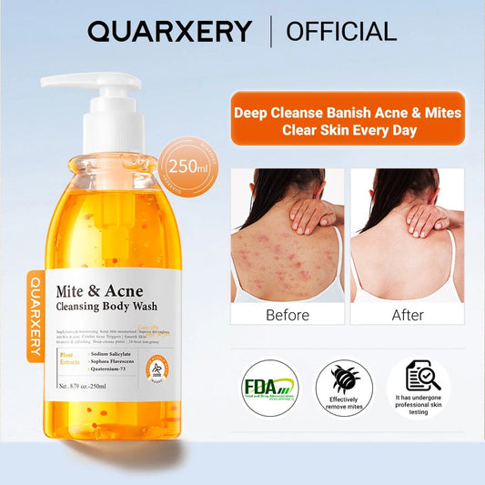 QUARXERY Mite & Acne Cleansing Body Wash  250ml