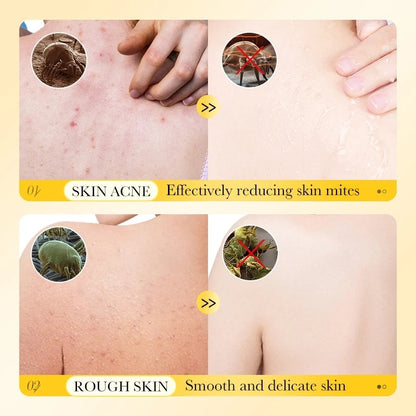 SADOER Sulfur Mite Removal Body Wash 500ml