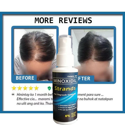 AUTHENTIC MINOXIDIL STRANDS