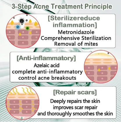 Anti-Acne Spot Cream