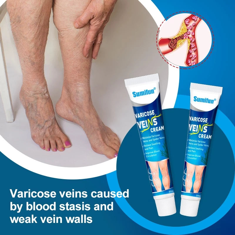 Varicose Veins Cream 20g