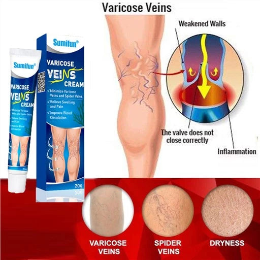 Varicose Veins Cream 20g