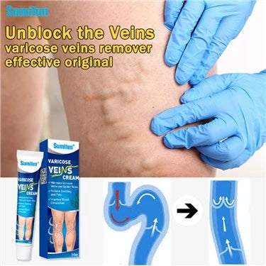 Varicose Veins Cream 20g