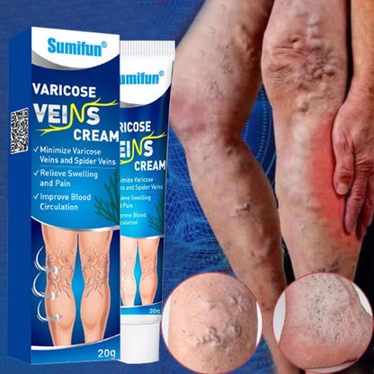 Varicose Veins Cream 20g