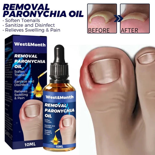 West & Month Removal Paronychia Oil