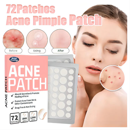 72 PCS Salicylic Pimple Patch Blemish Treatment