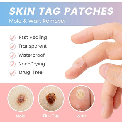 72 PCS Salicylic Pimple Patch Blemish Treatment