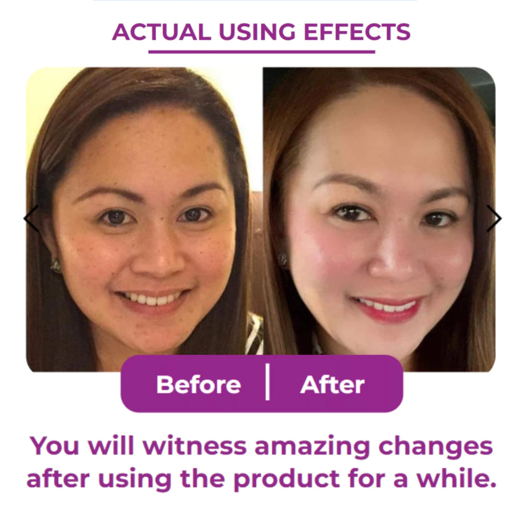 VENATURE Bakuchiol Retinol Serum 30ml – Gentle Yet Powerful Anti-Aging Care