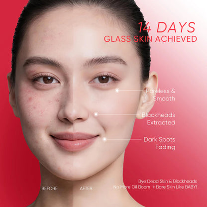 GMEELAN Centella AHA Peeling Serum 5X vC Brightening Exfoliating Even Skin Tone Facial Serum
