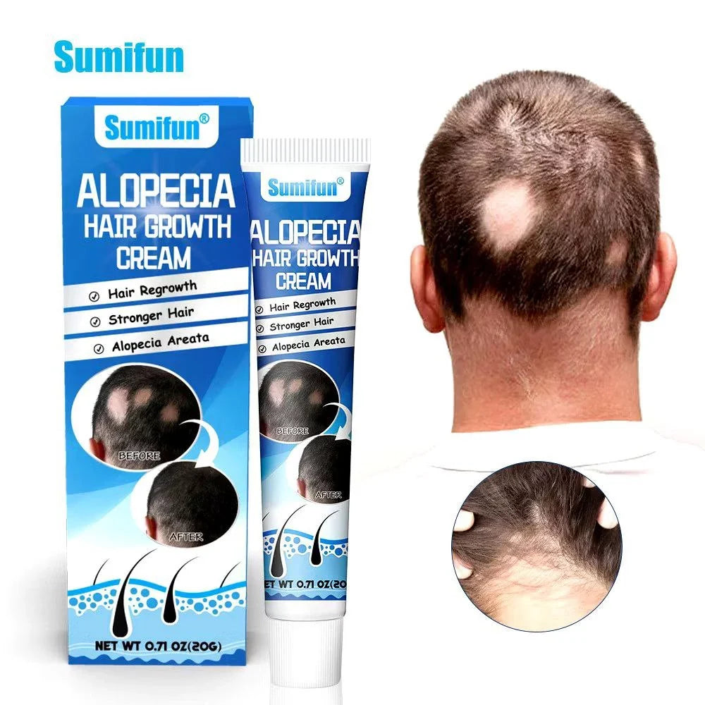 Sumifun Alopecia Hair Growth Cream 20g