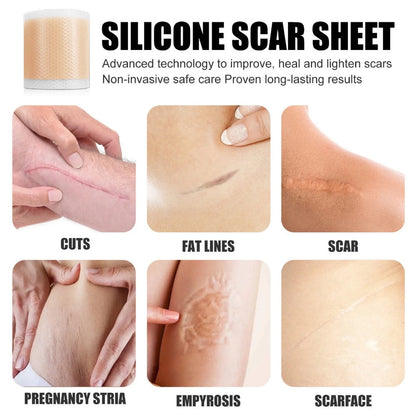 Silicone Scar Sheets