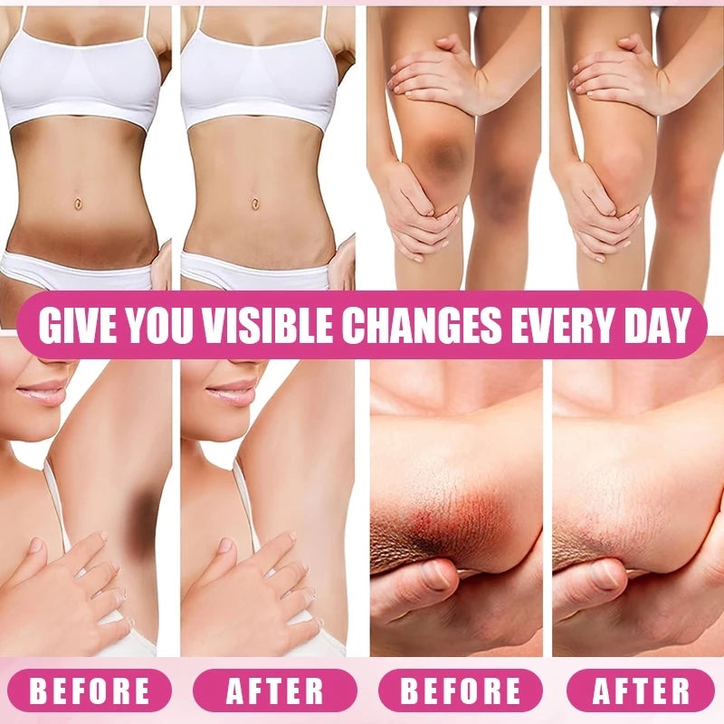 BUY 1 TAKE 1 | KORMESIC Kojic Acid Collagen Underarm Whitening Cream
