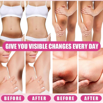 BUY 1 TAKE 1 | KORMESIC Kojic Acid Collagen Underarm Whitening Cream