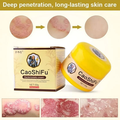 CaoShiFu Bacteriostatic Cream Skin Itching Eczema Psoriasis Solutions