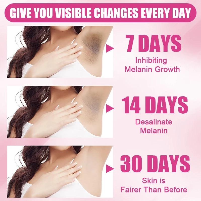 BUY 1 TAKE 1 | KORMESIC Kojic Acid Collagen Underarm Whitening Cream