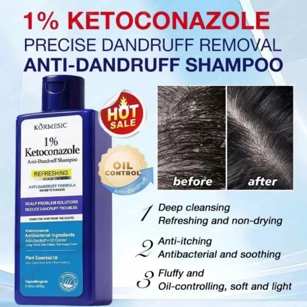 KORMESIC Anti-Dandruff Ketoconazole Shampoo for Scalp Treatment and Oil Control