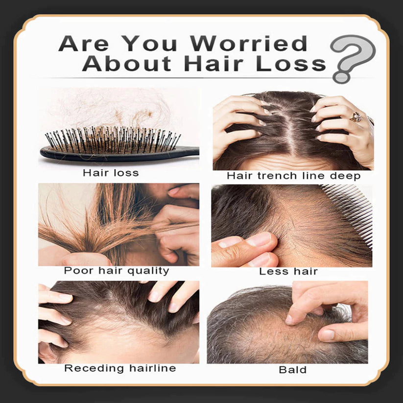 BUY 1 GET 1! HOSOKU 15% Minoxidil Hair Growth Serum (Oil Based)