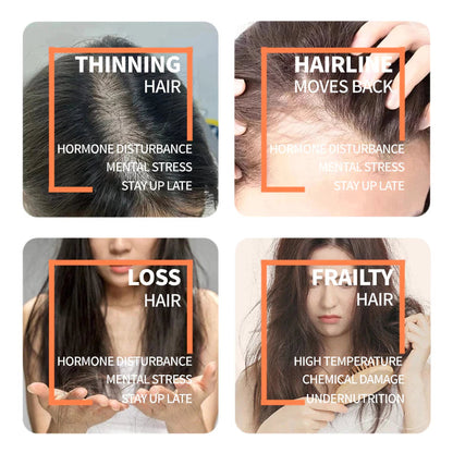 BUY 1 GET 1! HOSOKU 15% Minoxidil Hair Growth Serum (Oil Based)
