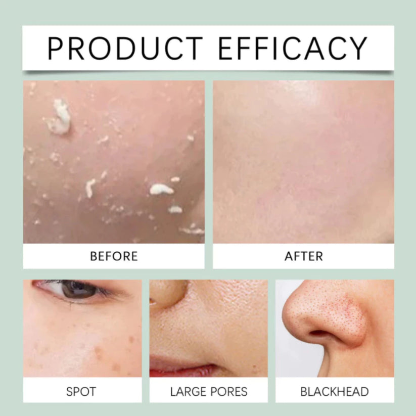 Lady Begin Mandelic Acid Tender Scrub Gel