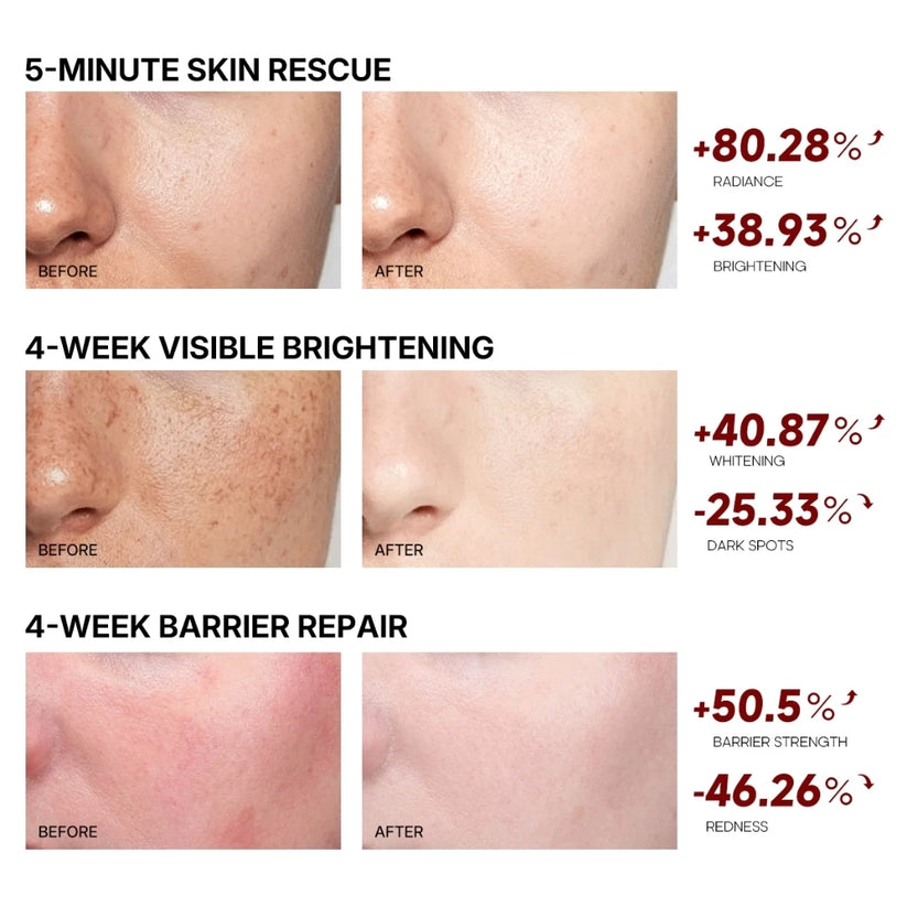 TEASHELL Niacinamide Brightening Skin Essence Cream Pro-Vitamin B5