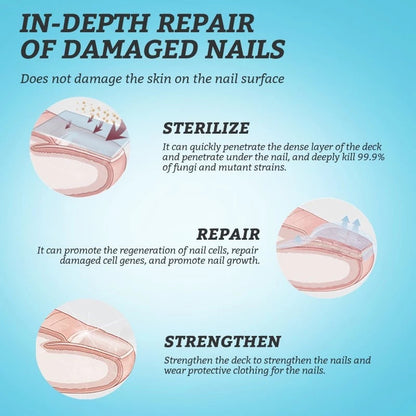 RtopR Ginger Antibacterial Nail Treatment