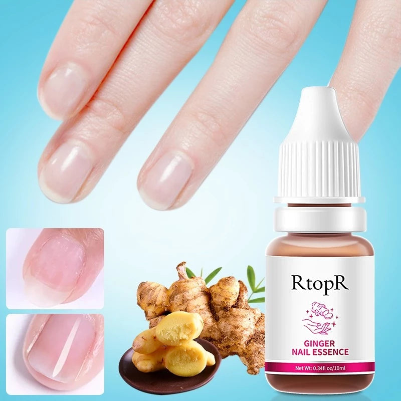 RtopR Ginger Antibacterial Nail Treatment