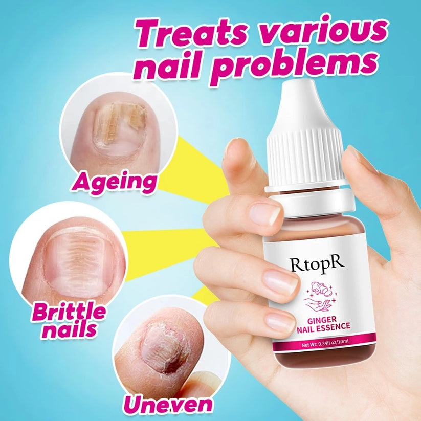 RtopR Ginger Antibacterial Nail Treatment