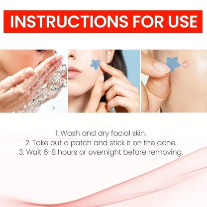 Star Pimple Patch