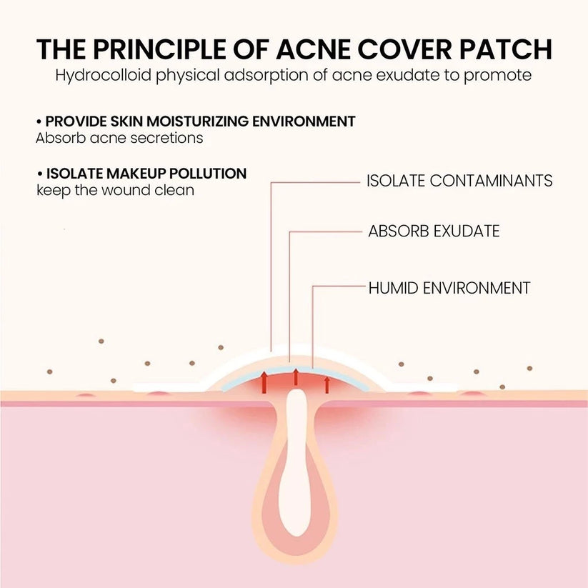 Star Pimple Patch