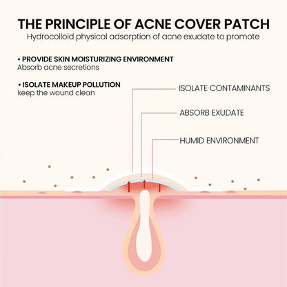 Star Pimple Patch