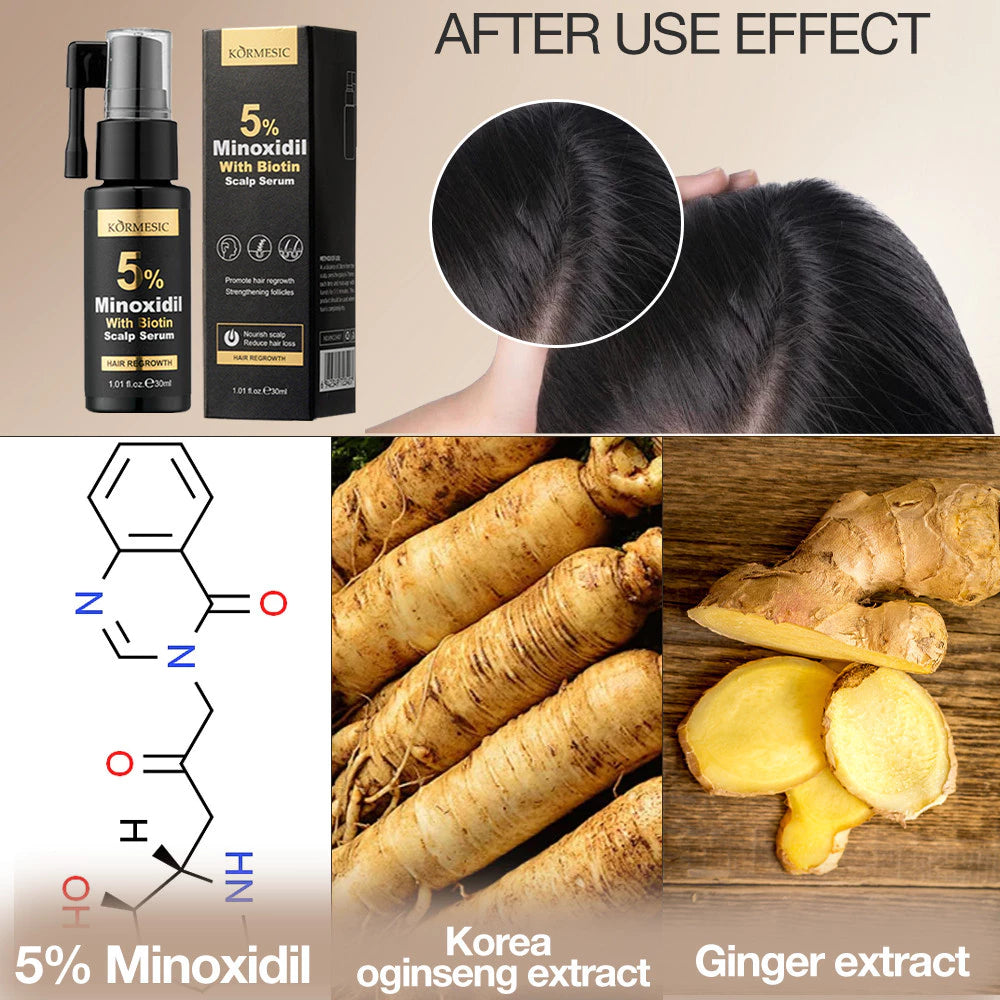 KORMESIC Minoxidil 5% with Biotin Scalp Serum 30ml