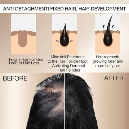 KORMESIC Minoxidil 5% with Biotin Scalp Serum 30ml